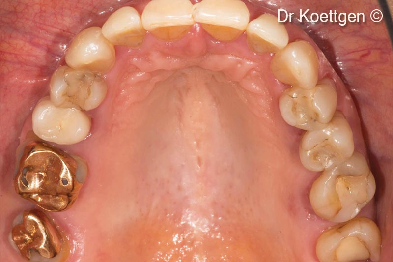 Tình hình ban đầu