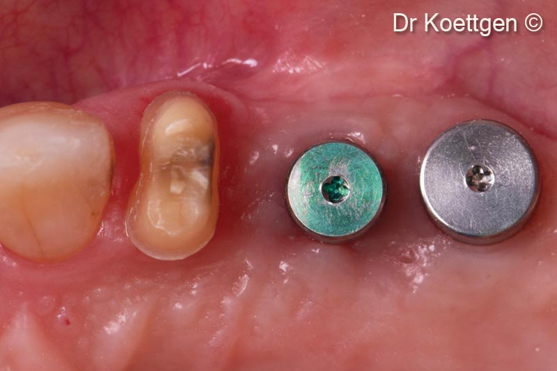 Tình trạng đã được chữa lành