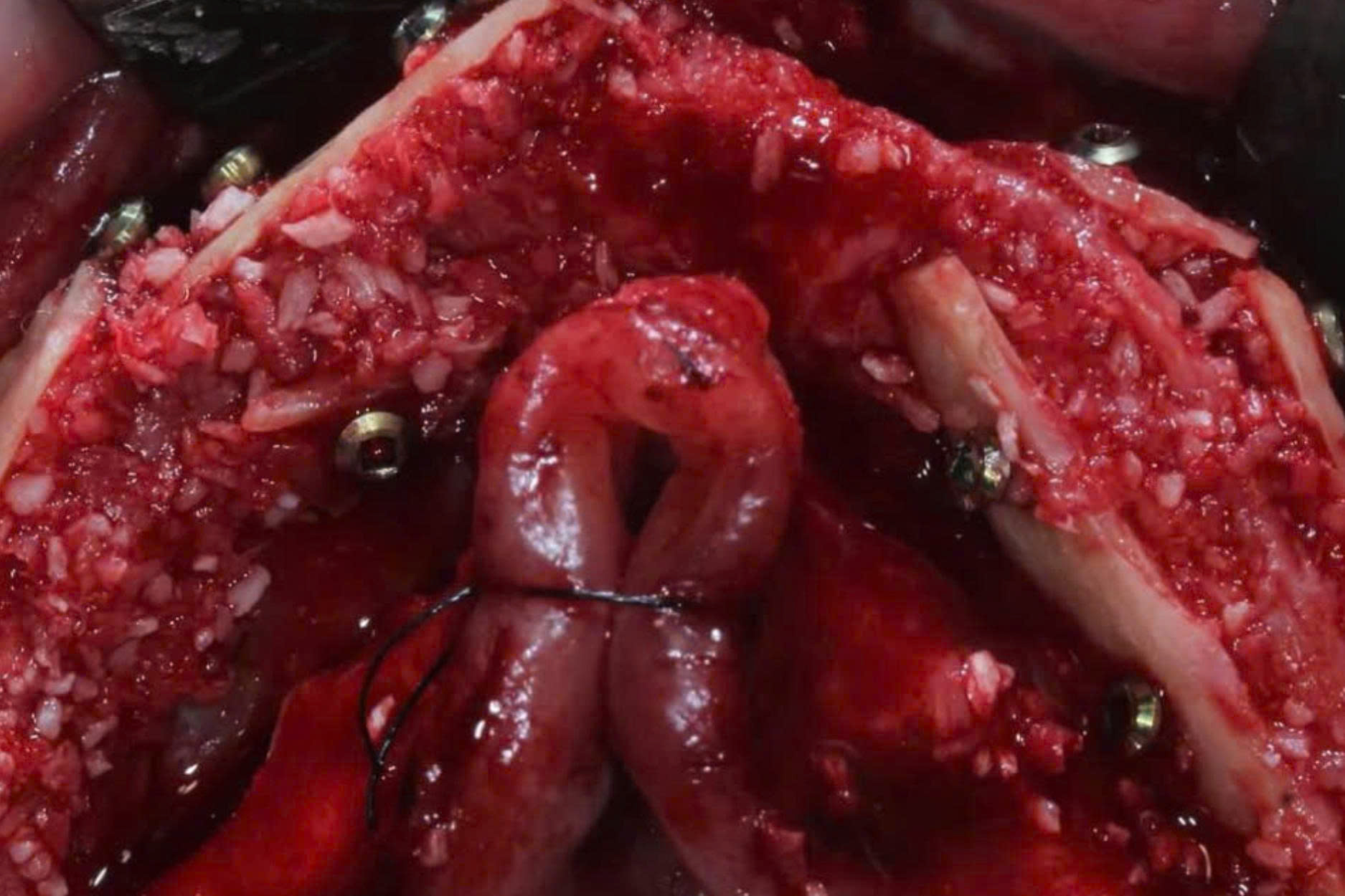 OsteoBiol Apatos (2)