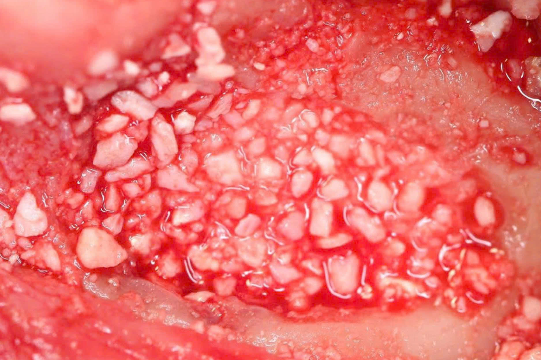 OsteoBiol Apatos (3)