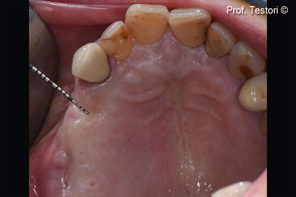 Hình ảnh lâm sàng của khuyết tật