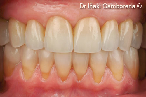 Kết quả cuối cùng