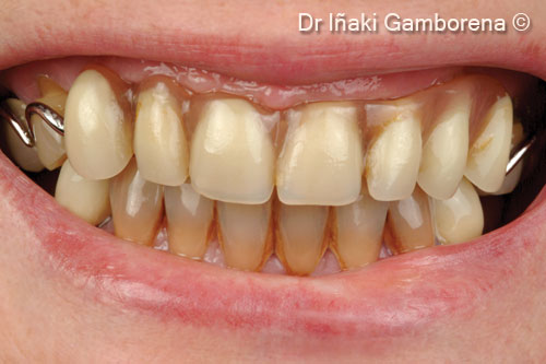 Hãy mỉm cười trước khi phẫu thuật