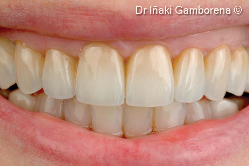 Hãy mỉm cười trước khi phẫu thuật