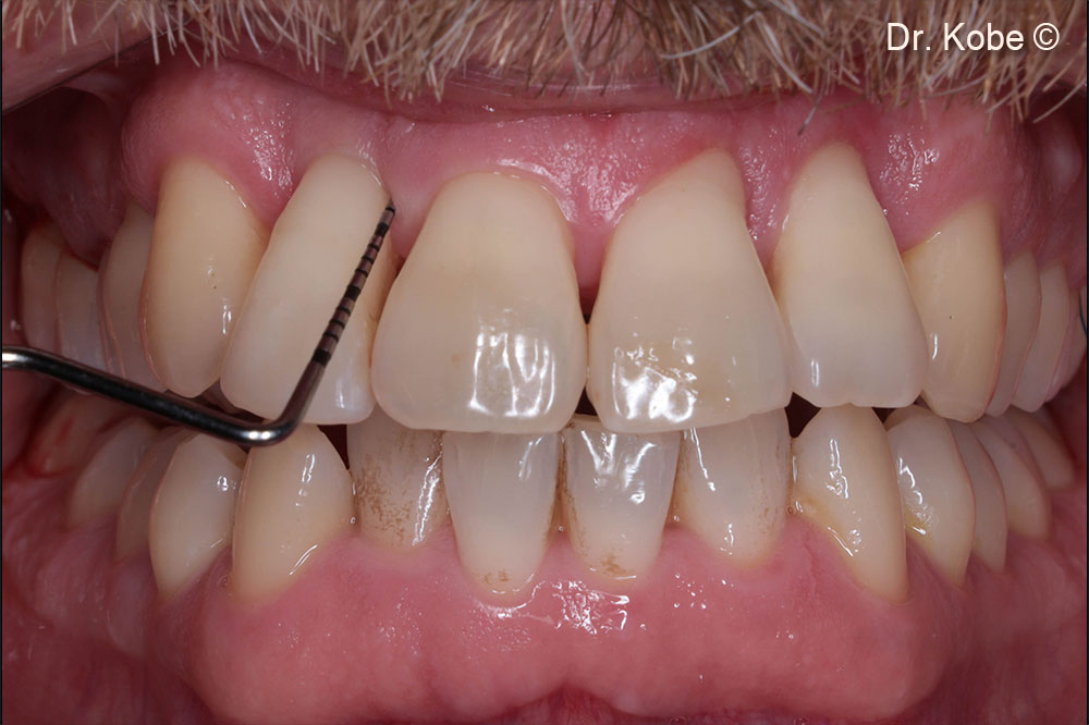 Theo dõi một năm ở góc phần tư thứ nhất