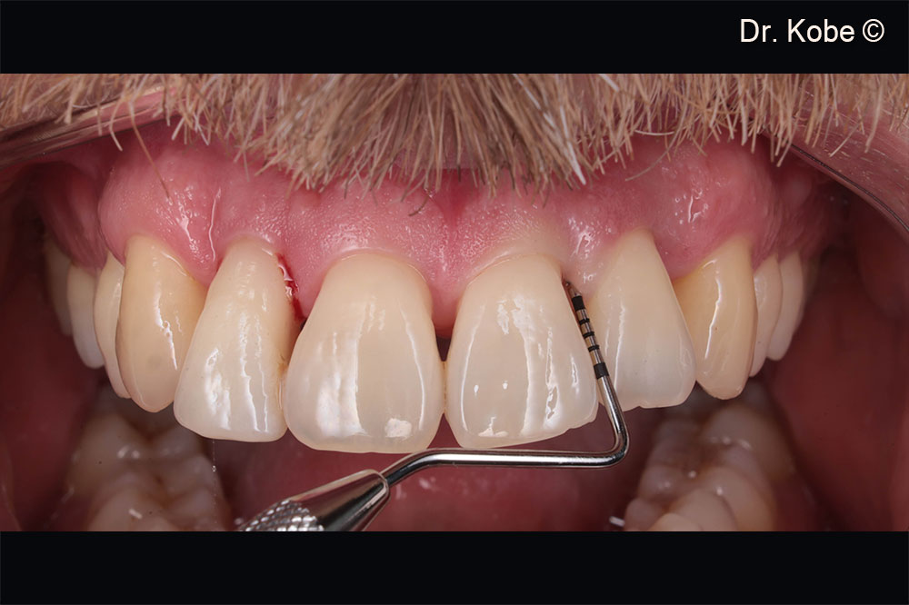 Tình hình ban đầu ở góc phần tư thứ hai