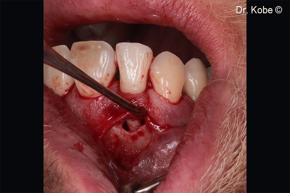 Truy cập vào lỗi