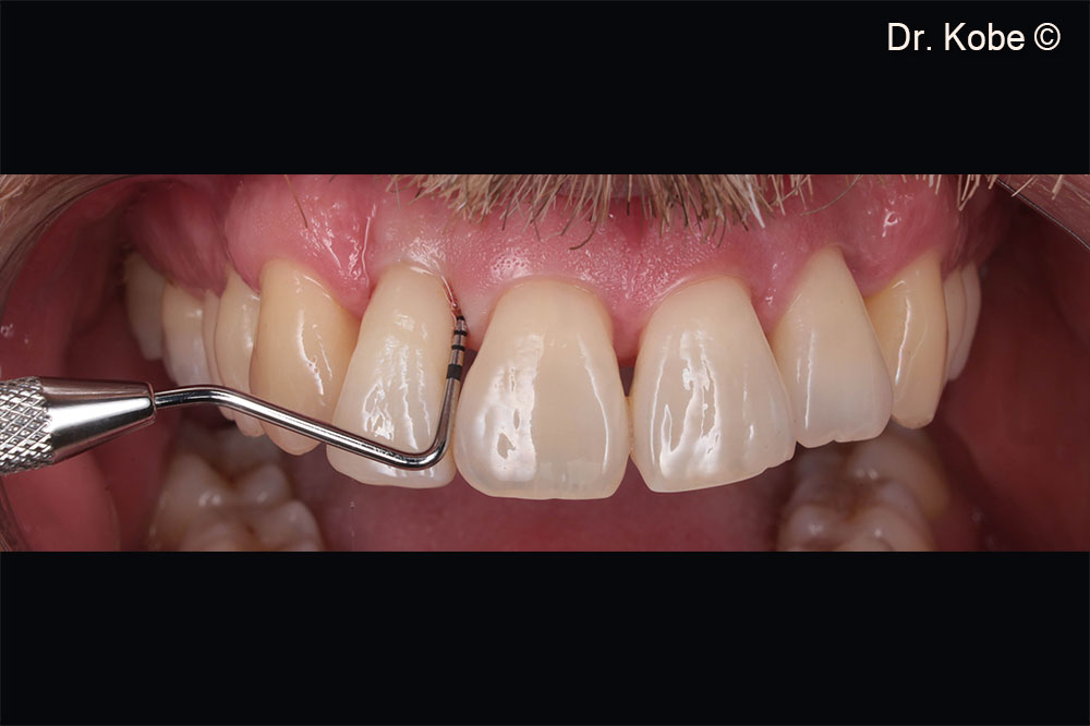 Tình hình ban đầu ở góc phần tư thứ nhất