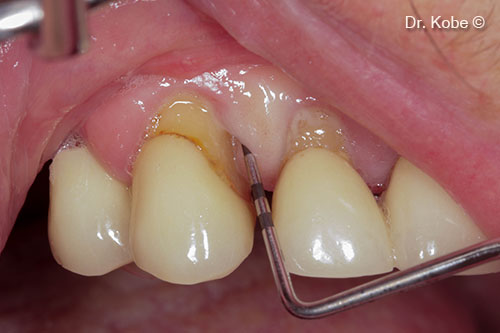 ton thuong nha chu 14