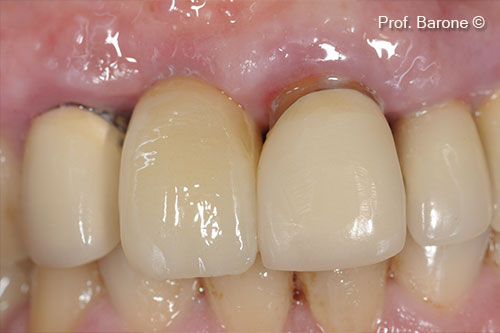 Vương miện cuối cùng