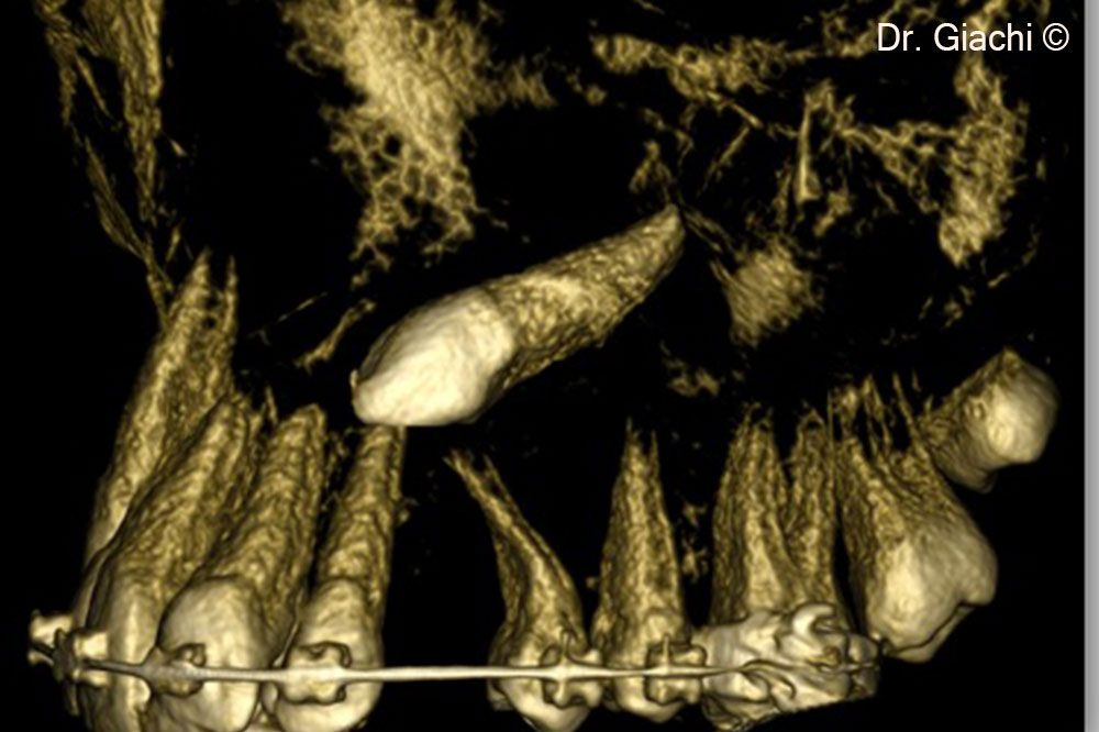 Hình ảnh CBCT hiển thị vị trí của chó