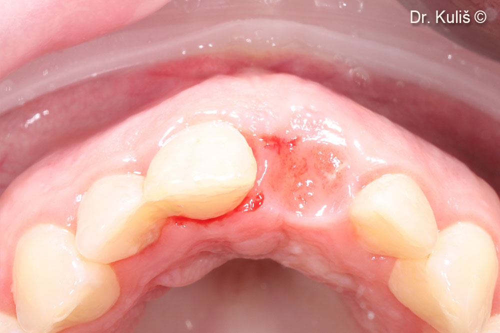 Tình trạng sau 6 tháng hồi phục