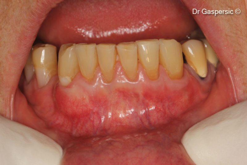 Toàn bộ khu vực sau 2 năm phẫu thuật