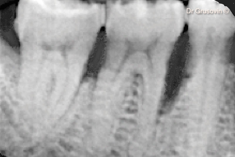 Ảnh chụp X-quang #46