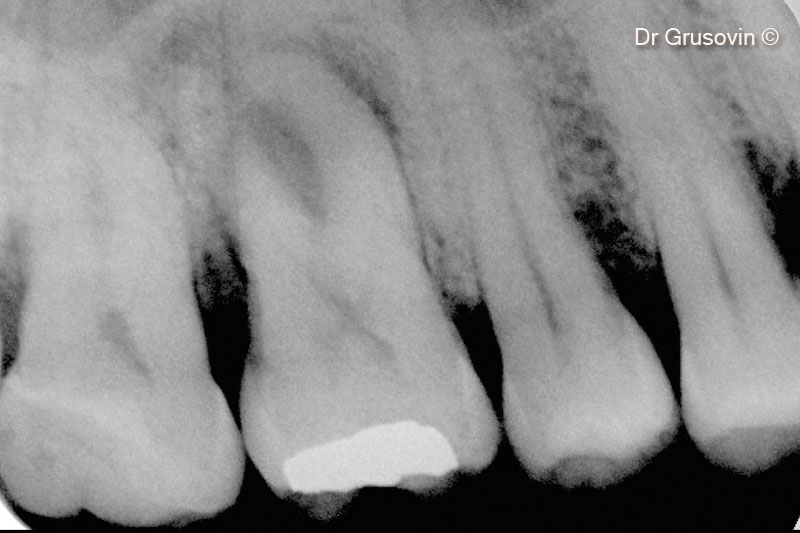 Hình ảnh X-Quang số 16